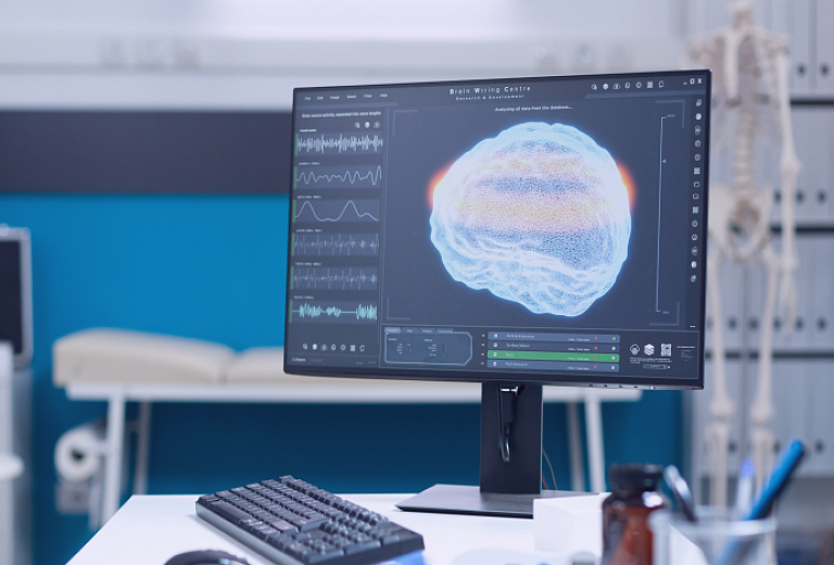 Новое в нашей диагностике: услуга ЭЭГ